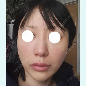 口コミ