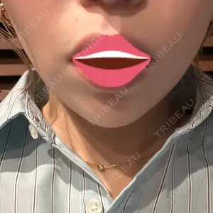 口コミ