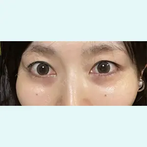 口コミ