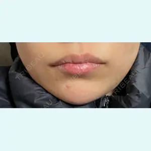 口コミ