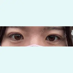 口コミ