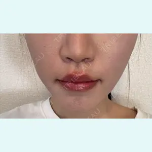 口コミ