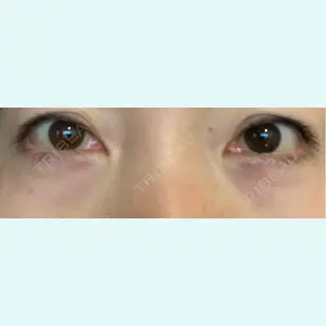 口コミ