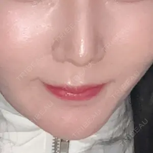 口コミ