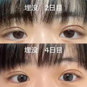 口コミ