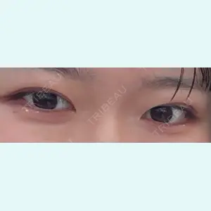 口コミ