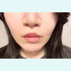 口コミ
