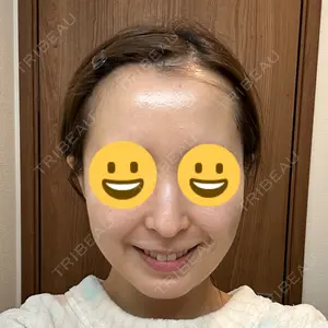 口コミ