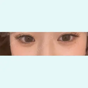 口コミ