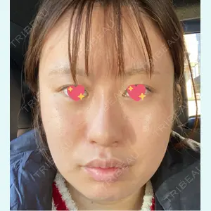 口コミ