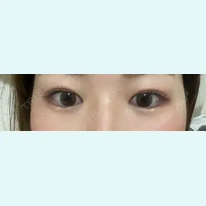 口コミ