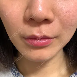 口コミ