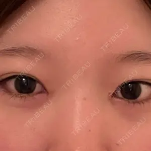 口コミ