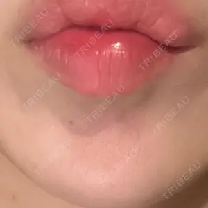 口コミ