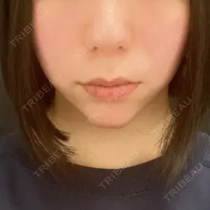 口コミ
