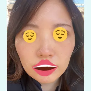 口コミ