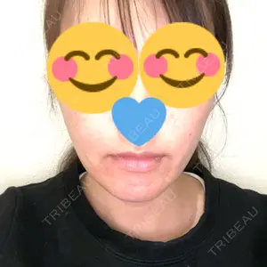 口コミ