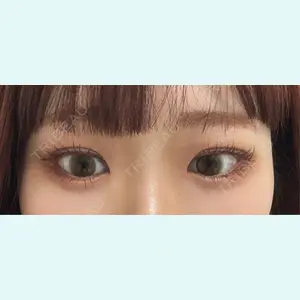 口コミ