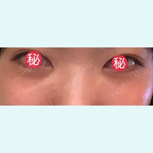 口コミ