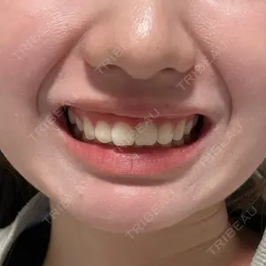 口コミ