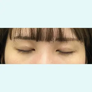 口コミ