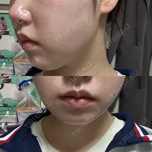 口コミ