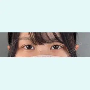 口コミ