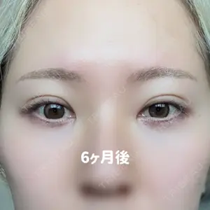 口コミ