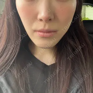 口コミ