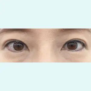 口コミ