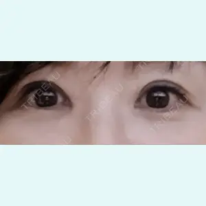 口コミ