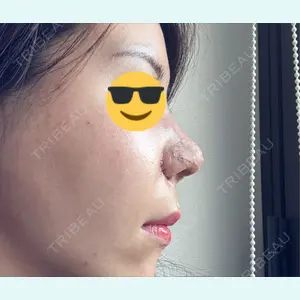 口コミ