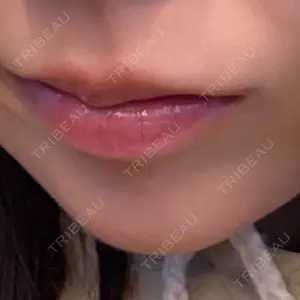 口コミ