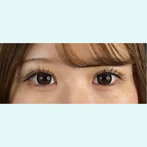 口コミ