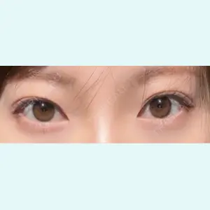口コミ