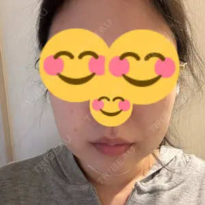 口コミ