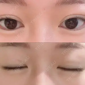 口コミ