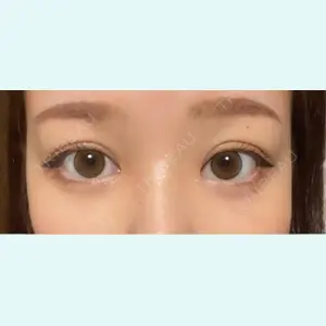 口コミ