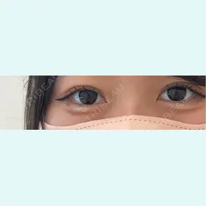 口コミ