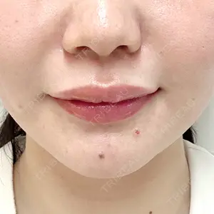 口コミ