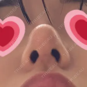口コミ