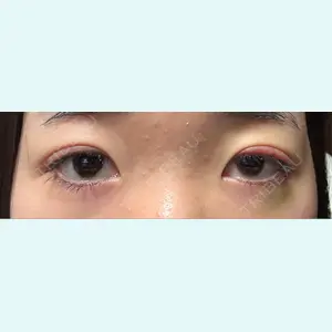 口コミ