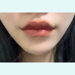口コミ