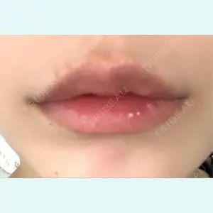 口コミ