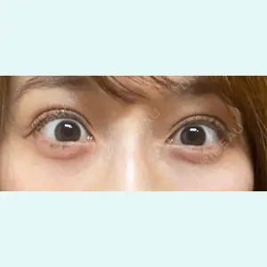 口コミ