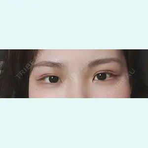 口コミ