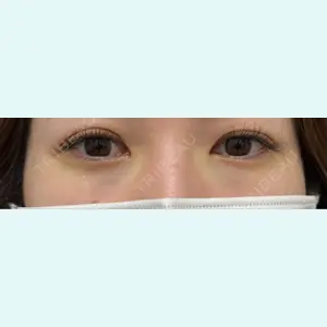 口コミ