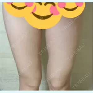 口コミ
