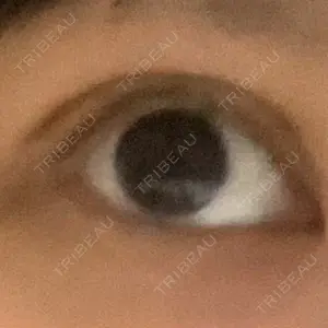 口コミ