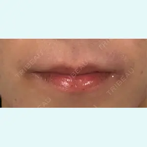 口コミ